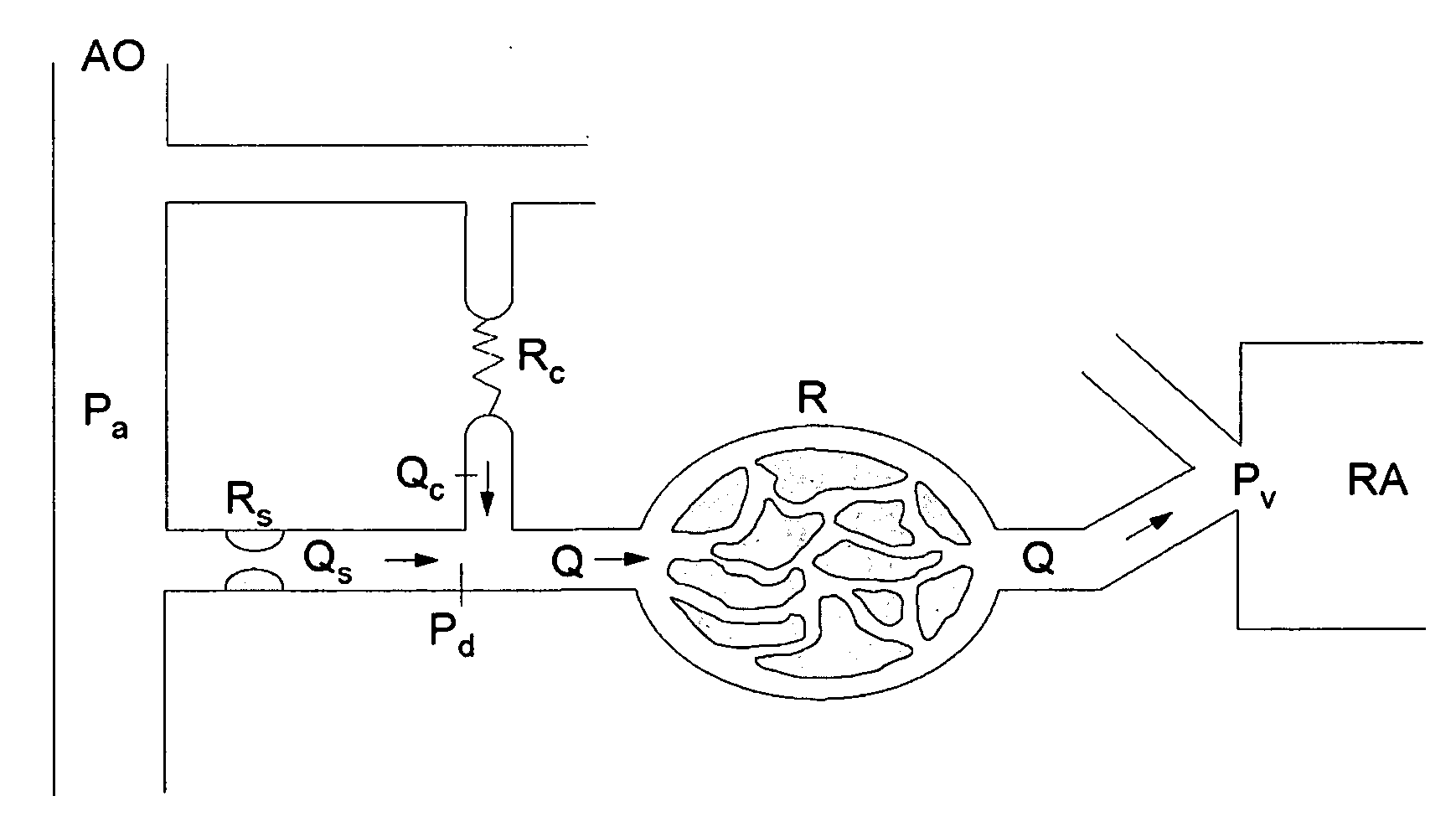 Method for determining the blood flow in a coronary artery