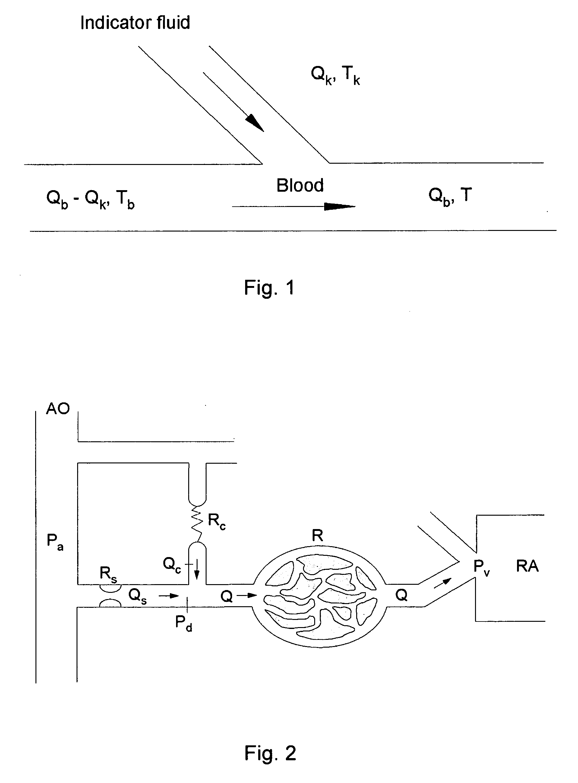 Method for determining the blood flow in a coronary artery