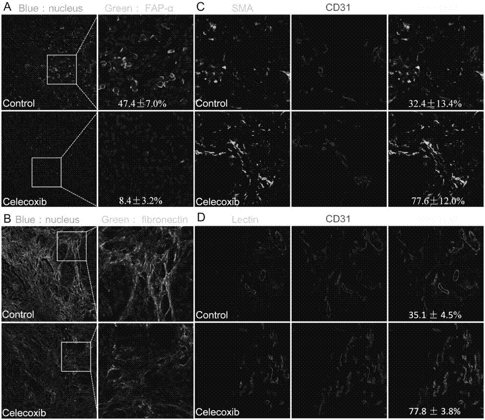 Cyclooxygenase-2 inhibitor and nano-drug delivery system drug composition and application thereof