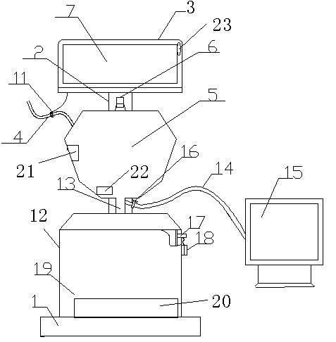 Medical dynamic urine volume detector