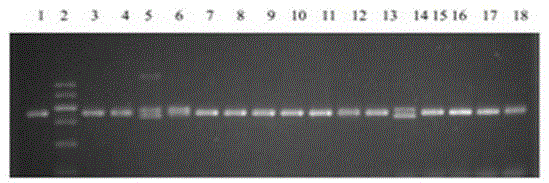 Method of knocking out spinal muscular atrophy SMN genes and cell model