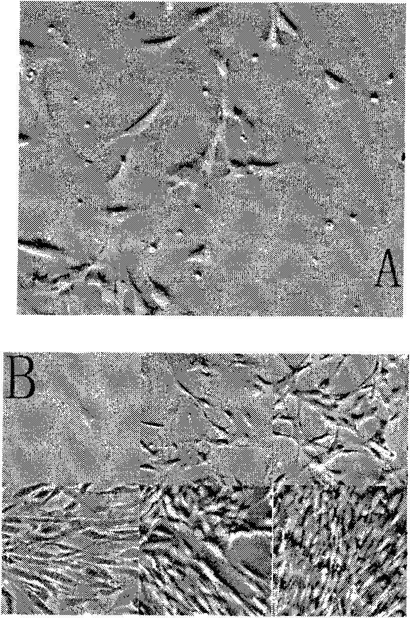 In vitro amplification method of human marrow pluripotent stem cells and method for directionally differentiating same into dopaminergic neuron