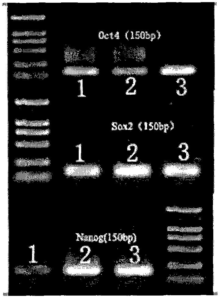 In vitro amplification method of human marrow pluripotent stem cells and method for directionally differentiating same into dopaminergic neuron