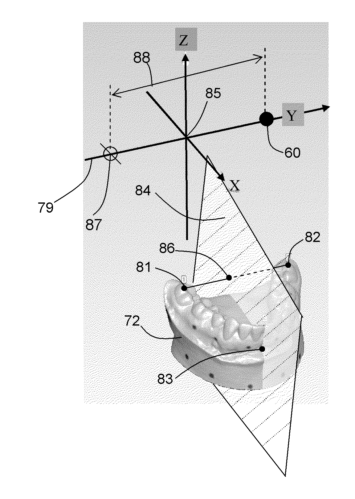 Method Of Designing Custom Articulator Inserts Using Four-Dimensional Data