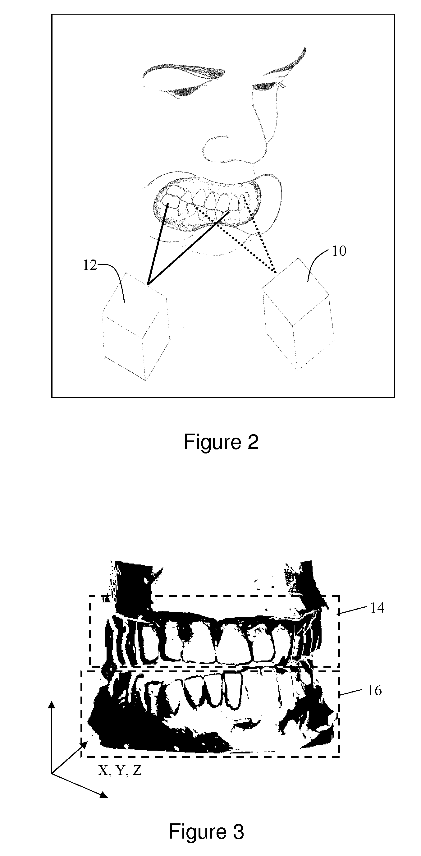 Method Of Designing Custom Articulator Inserts Using Four-Dimensional Data