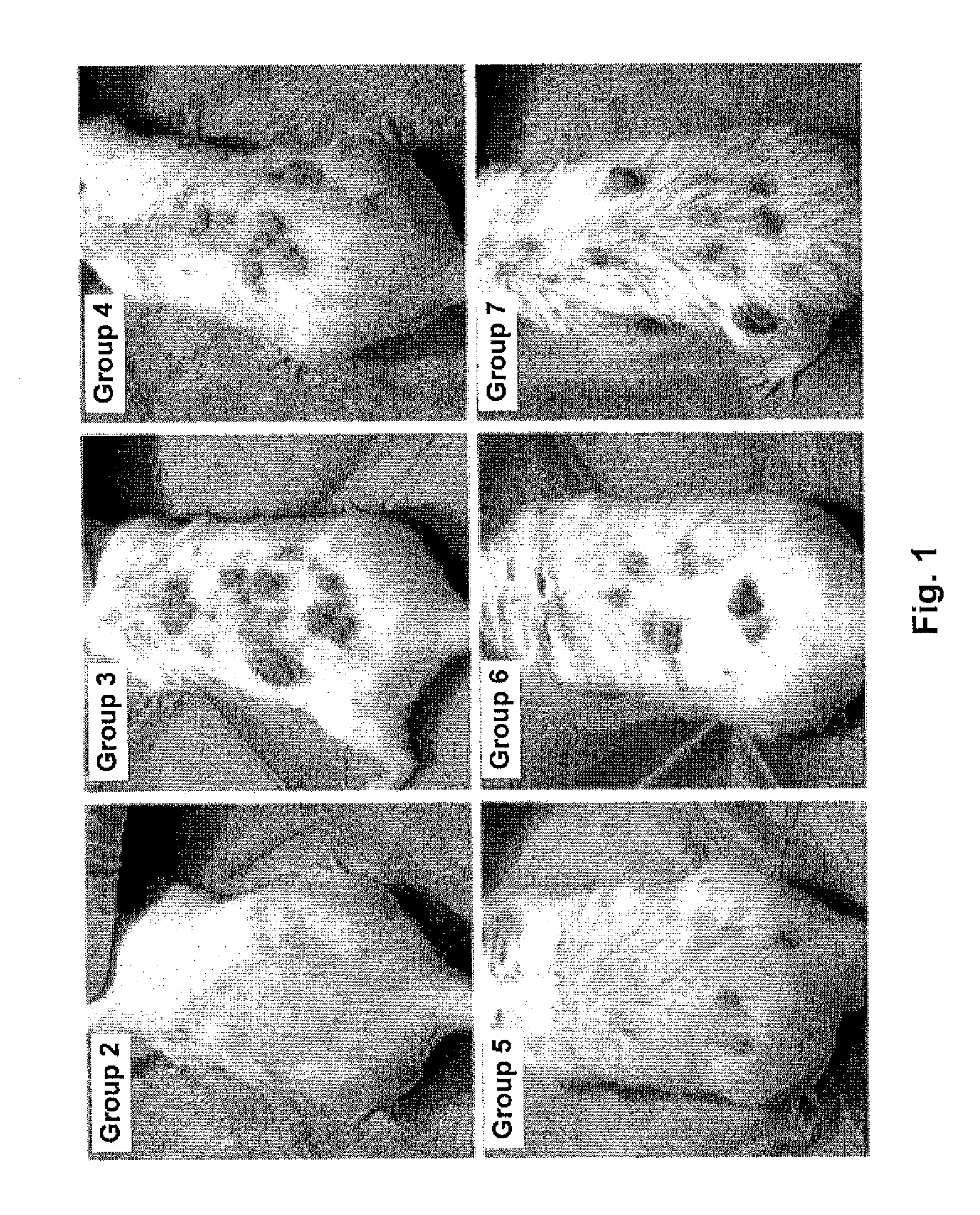 Peptide for the Prophylactic or Therapeutic Treatment of Skin Tumors in Initial Stages