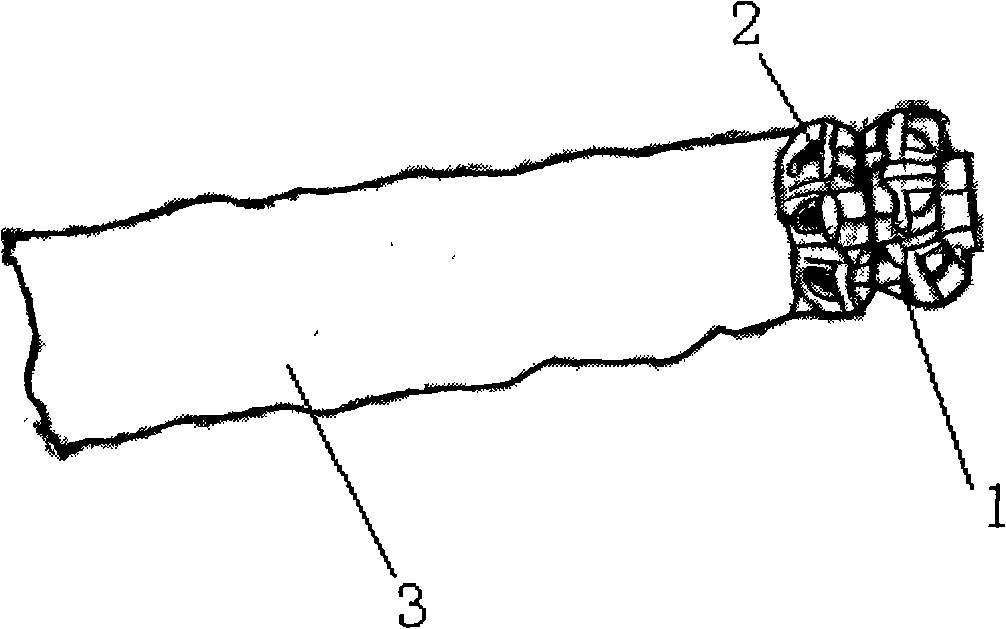 Intestinal canal inner pass-by device based on Valtrac anastomosis ring