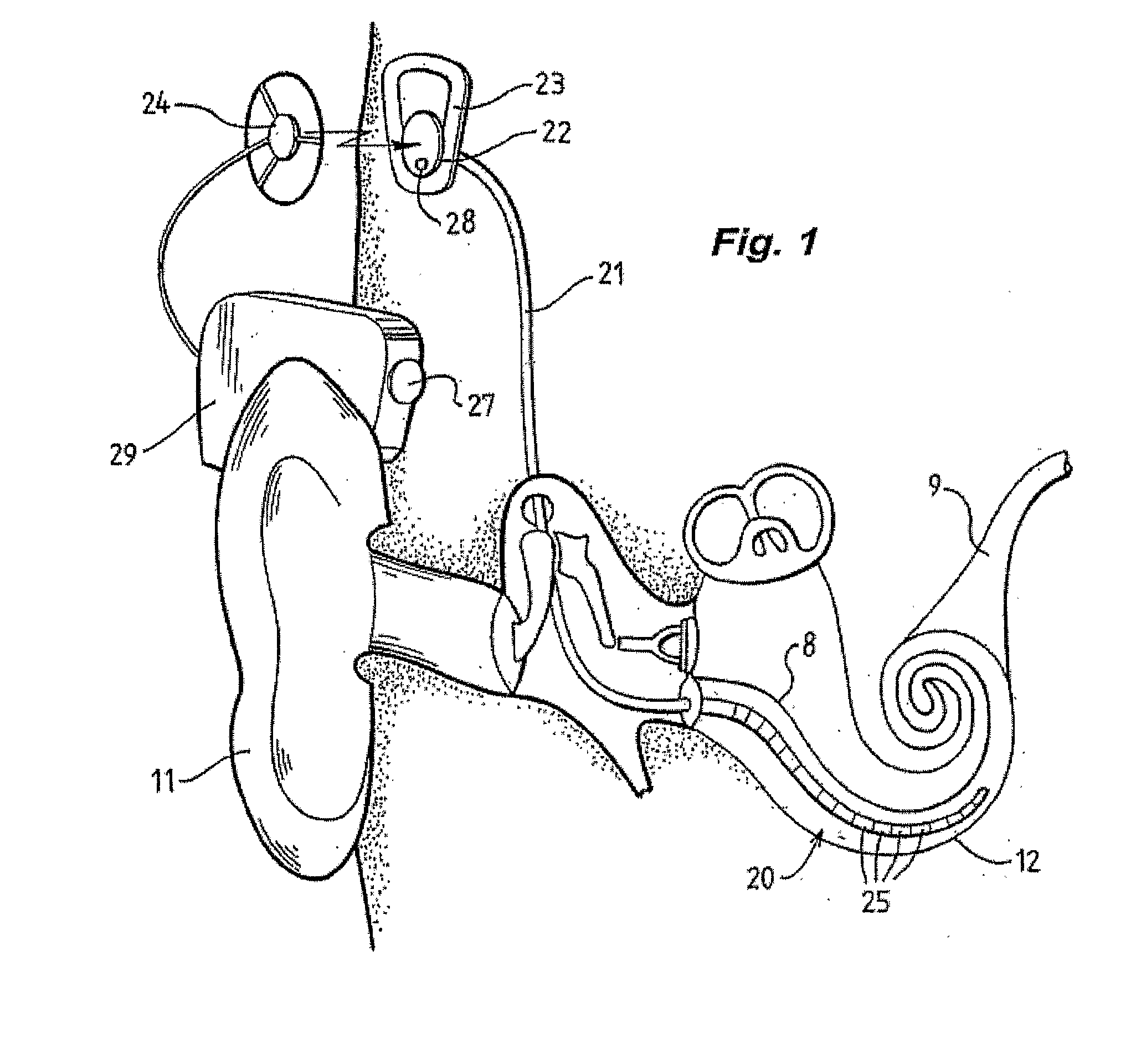 Electrode fault detection