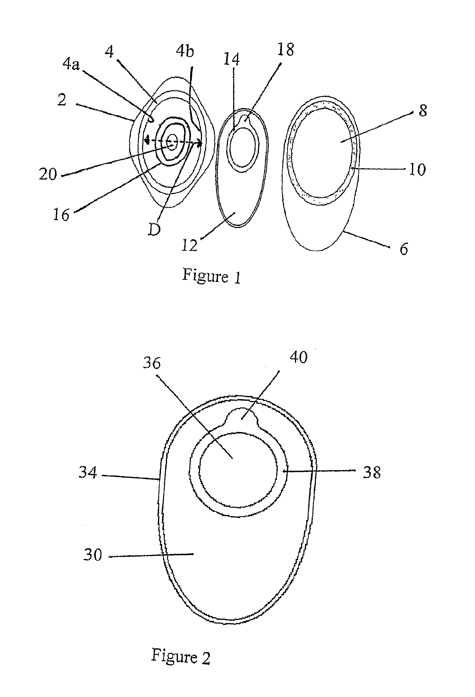 Ostomy bag