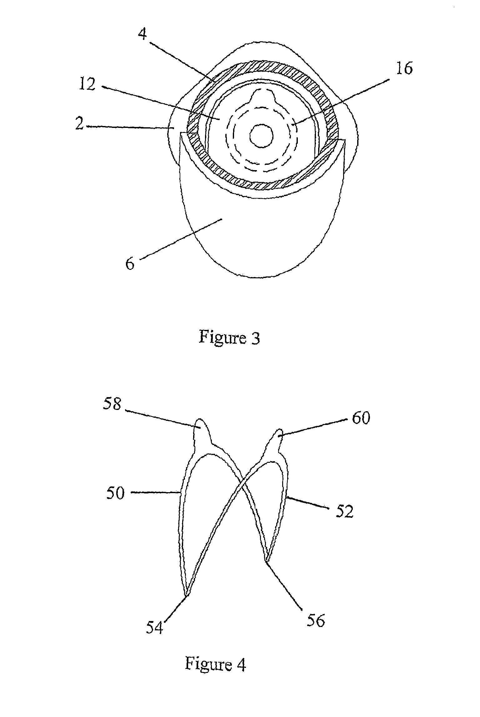 Ostomy bag