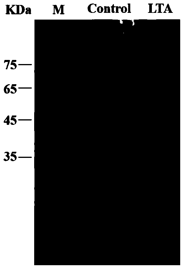 L-threonine aldolase and application of L-threonine aldolase to synthesis of methylsulfonylphenylserine