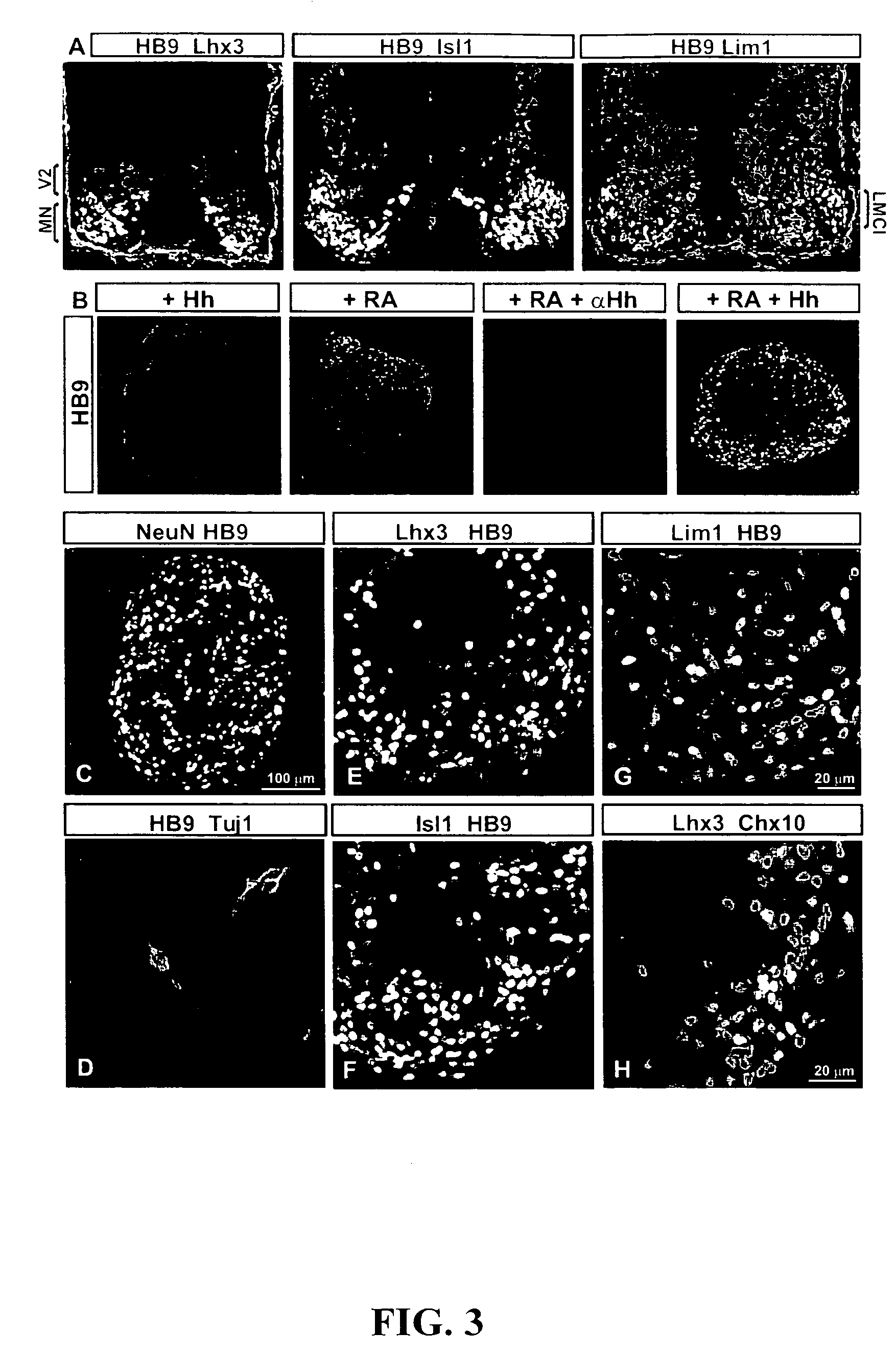 Systems and methods for screening for modulators of neural differentiation