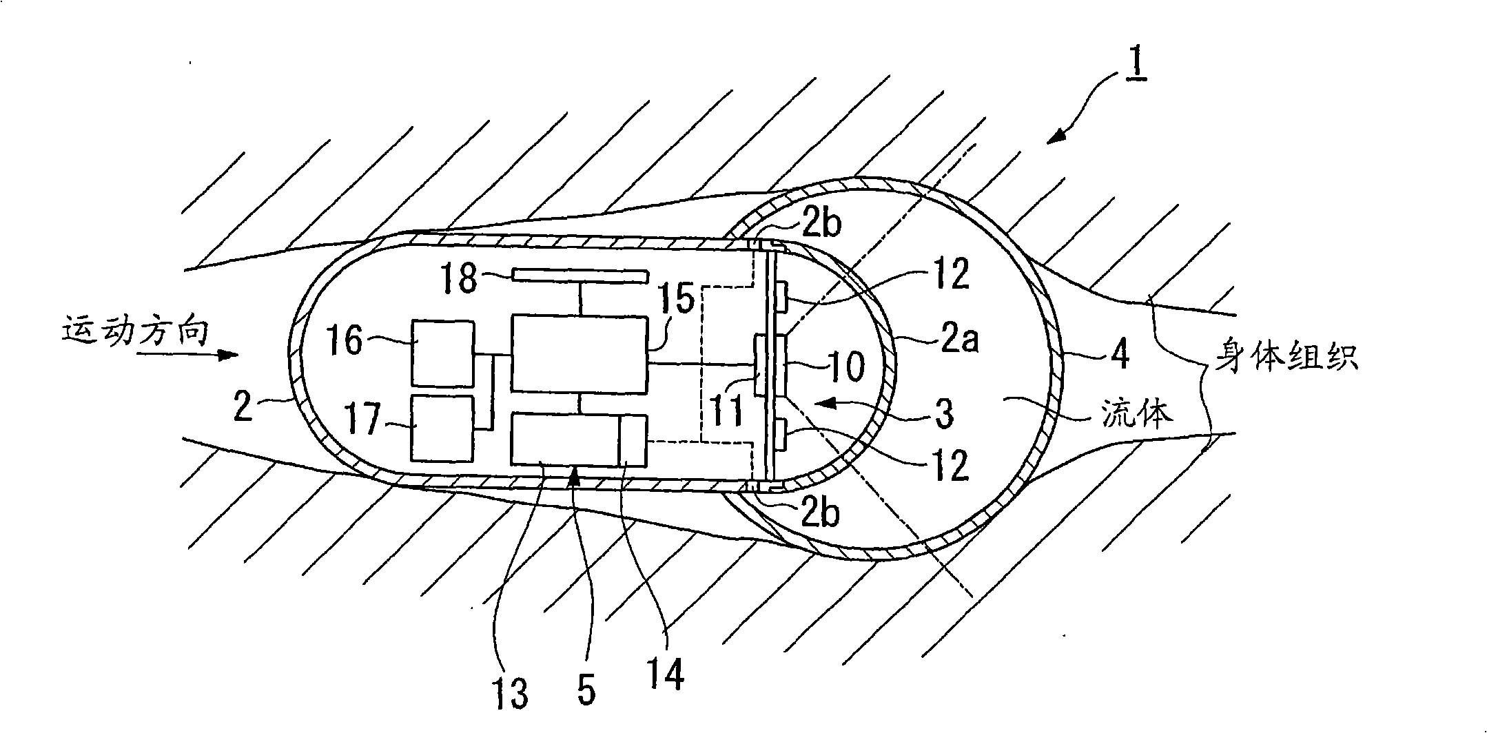 Body inside observation device