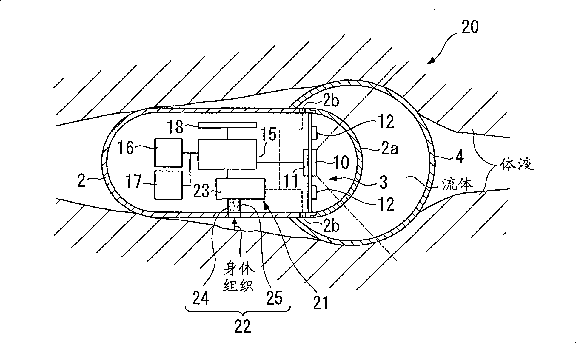 Body inside observation device