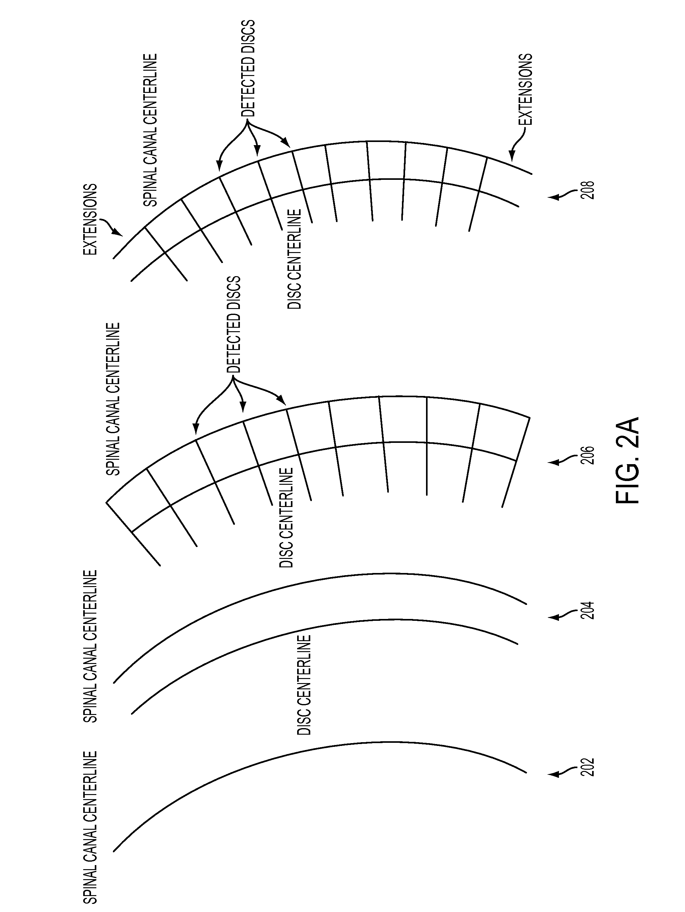 Method and system for automatic detection of spinal bone lesions in 3D medical image data