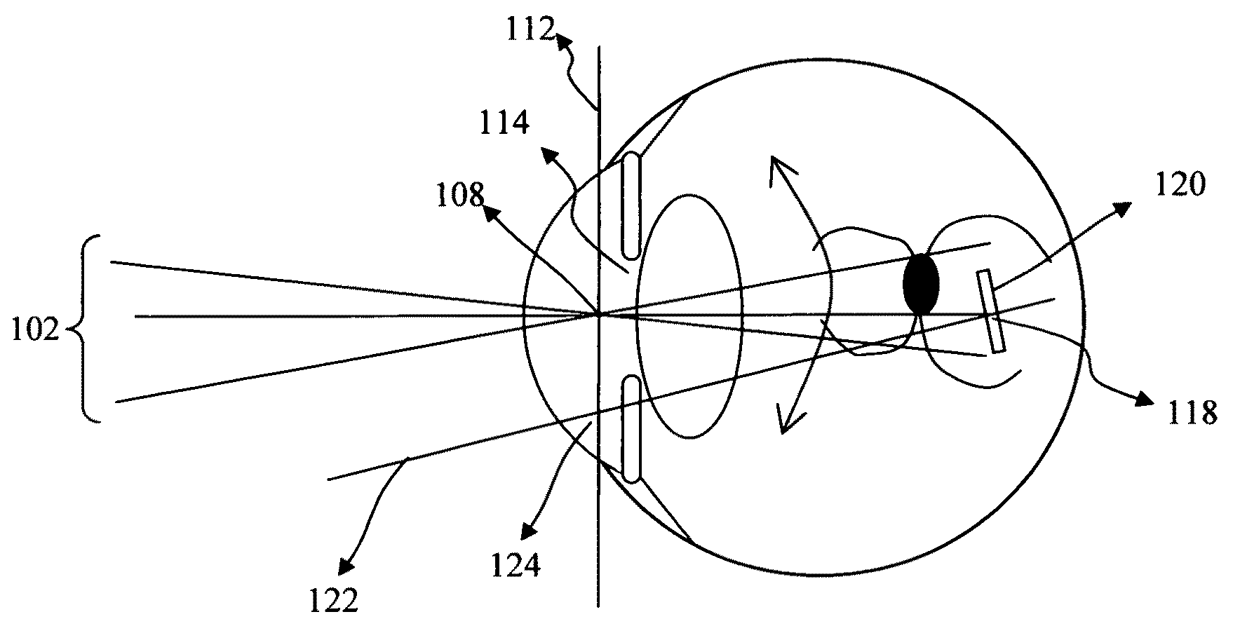 Electronic ophthalmoscope for selective retinal photodisruption of the photoreceptor mosaic