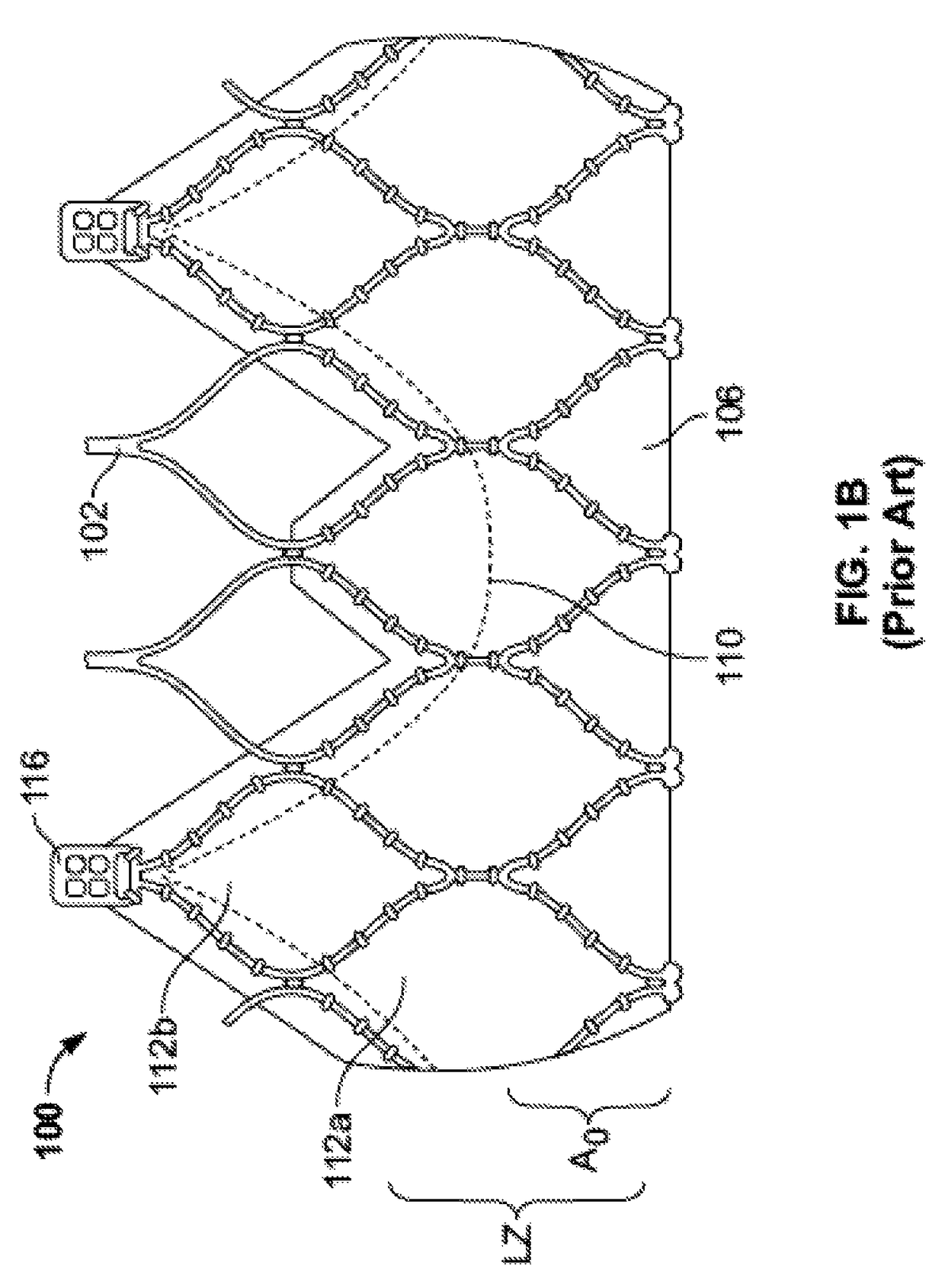 Reduced profile prosthetic heart valve