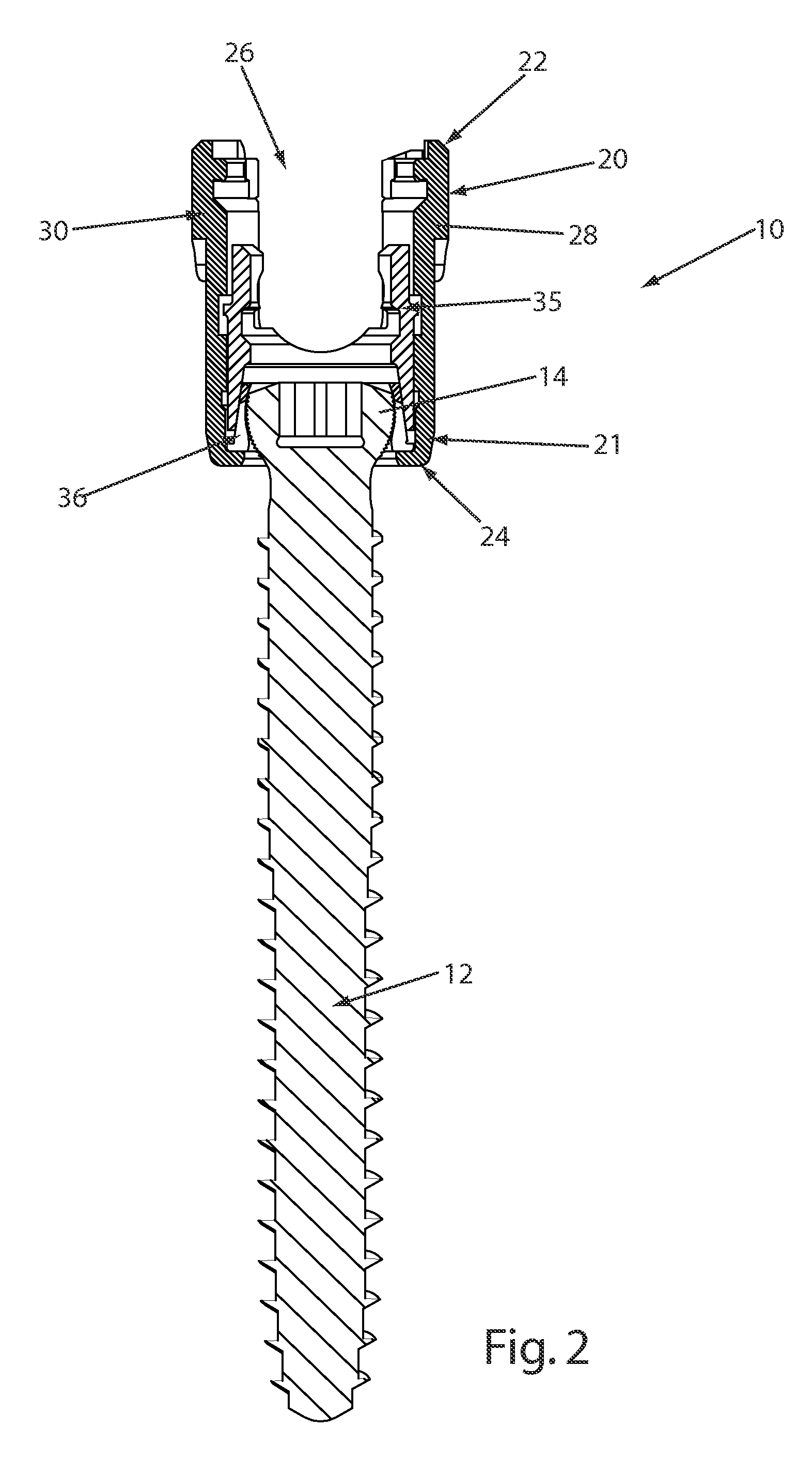 Reduction sleeve