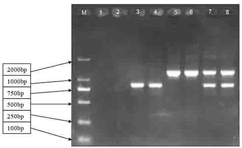 Alpha-thalassemia related gene detection kit