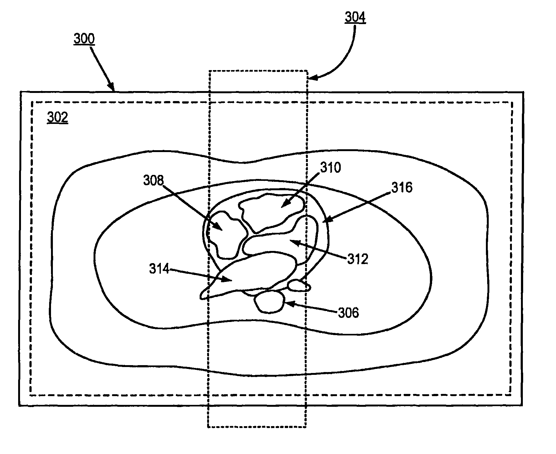 Method for non-contrast enhanced pulmonary vein magnetic resonance imaging