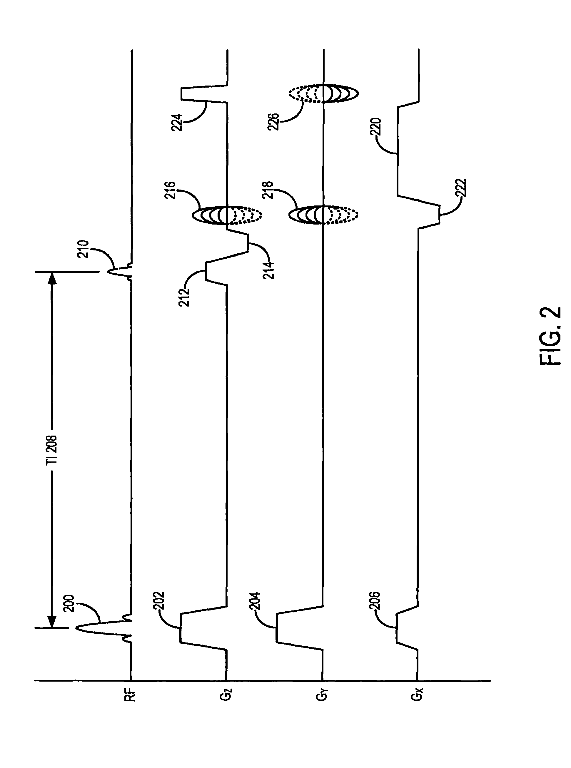 Method for non-contrast enhanced pulmonary vein magnetic resonance imaging