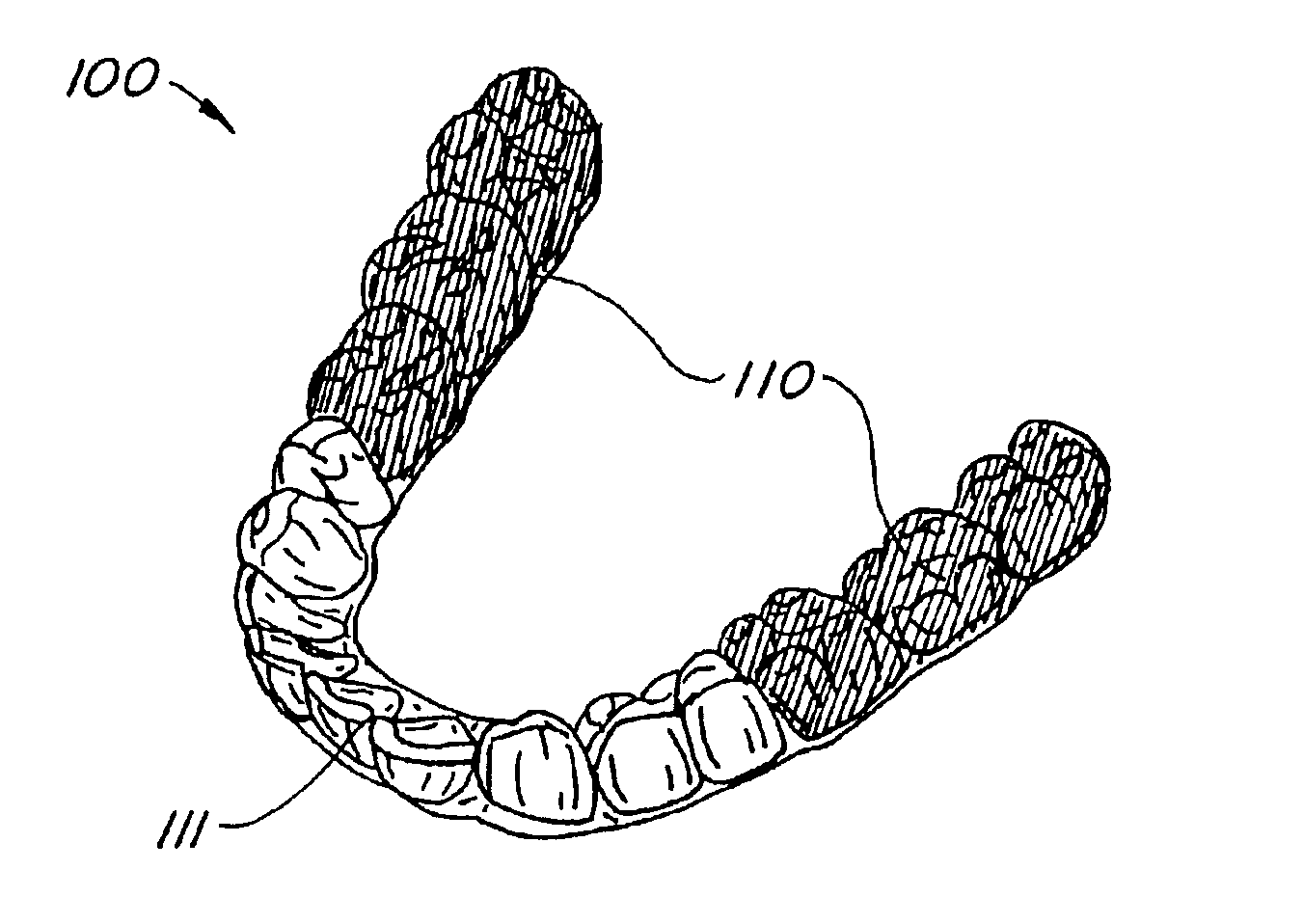 Systems and methods for varying elastic modulus appliances