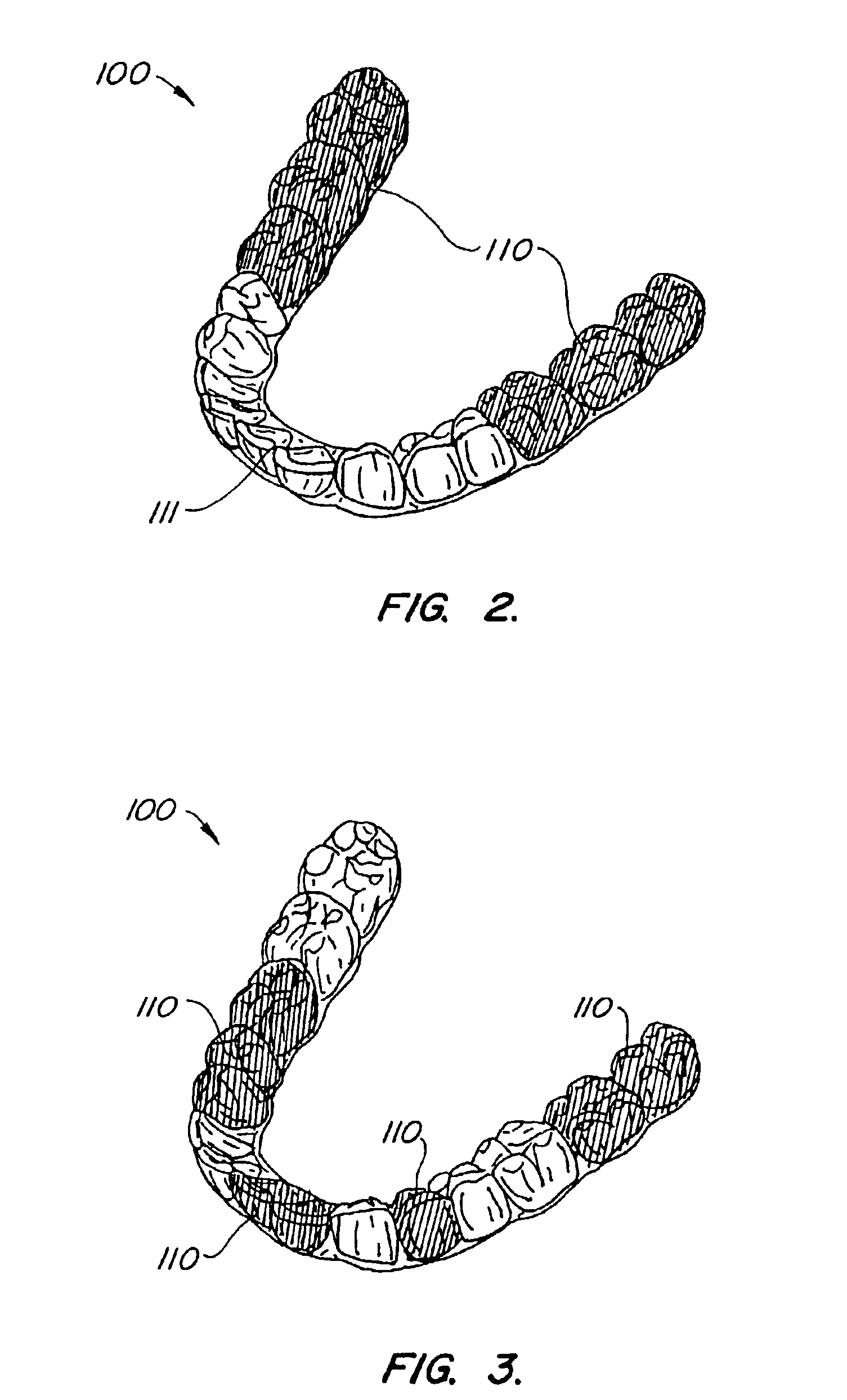 Systems and methods for varying elastic modulus appliances