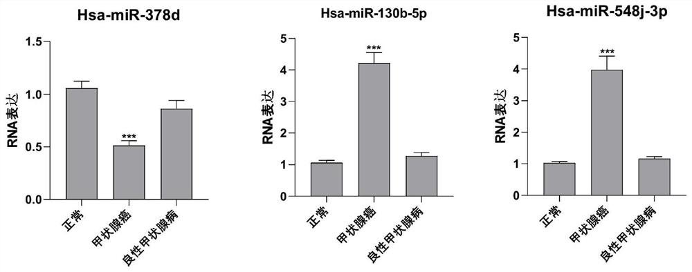 Serum miRNA combination for thyroid tumor diagnosis and 131 iodine treatment and prognosis