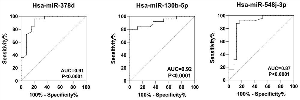 Serum miRNA combination for thyroid tumor diagnosis and 131 iodine treatment and prognosis