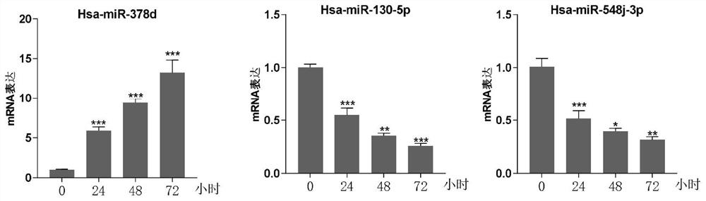 Serum miRNA combination for thyroid tumor diagnosis and 131 iodine treatment and prognosis