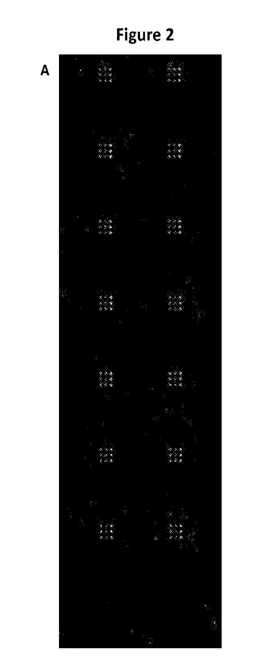 Pancreatic cancer markers