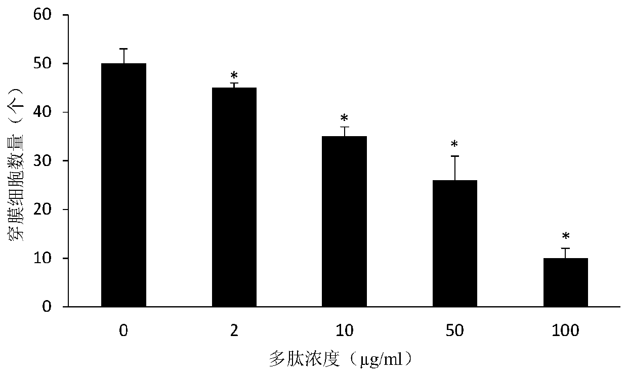 Polypeptide Inducing Prostate Cancer Cell Apoptosis and Its Application