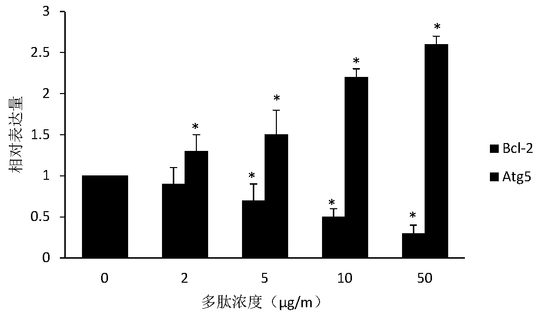 Polypeptide Inducing Prostate Cancer Cell Apoptosis and Its Application