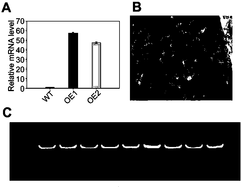 Gene for improving cadmium accumulation and tolerance of plant, and application thereof