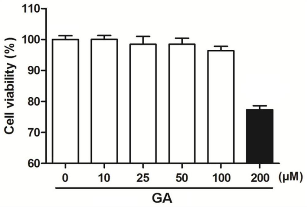 Application of carbenoxolone in preparation of anti-Zika virus medicine