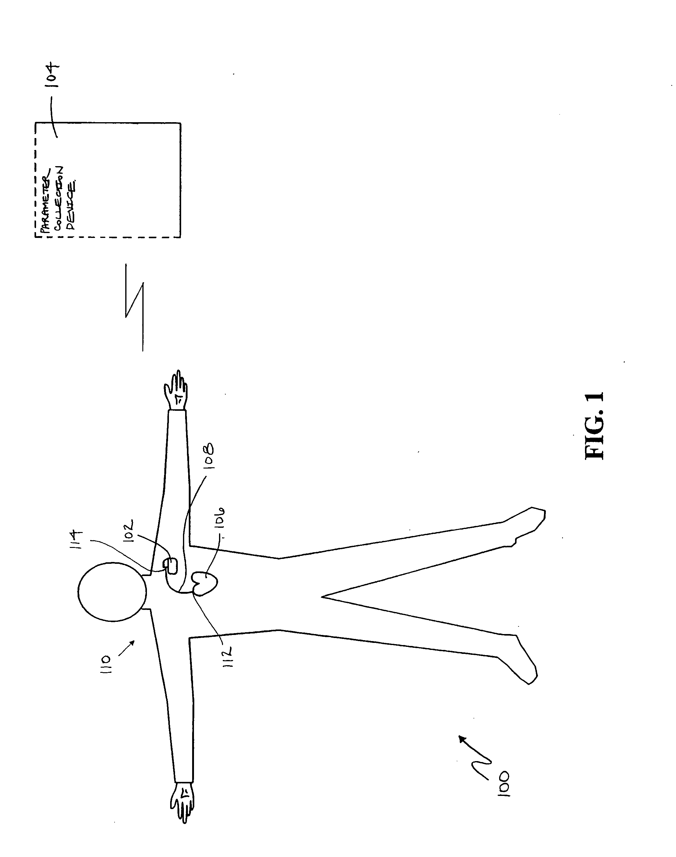 Prediction of thoracic fluid accumulation