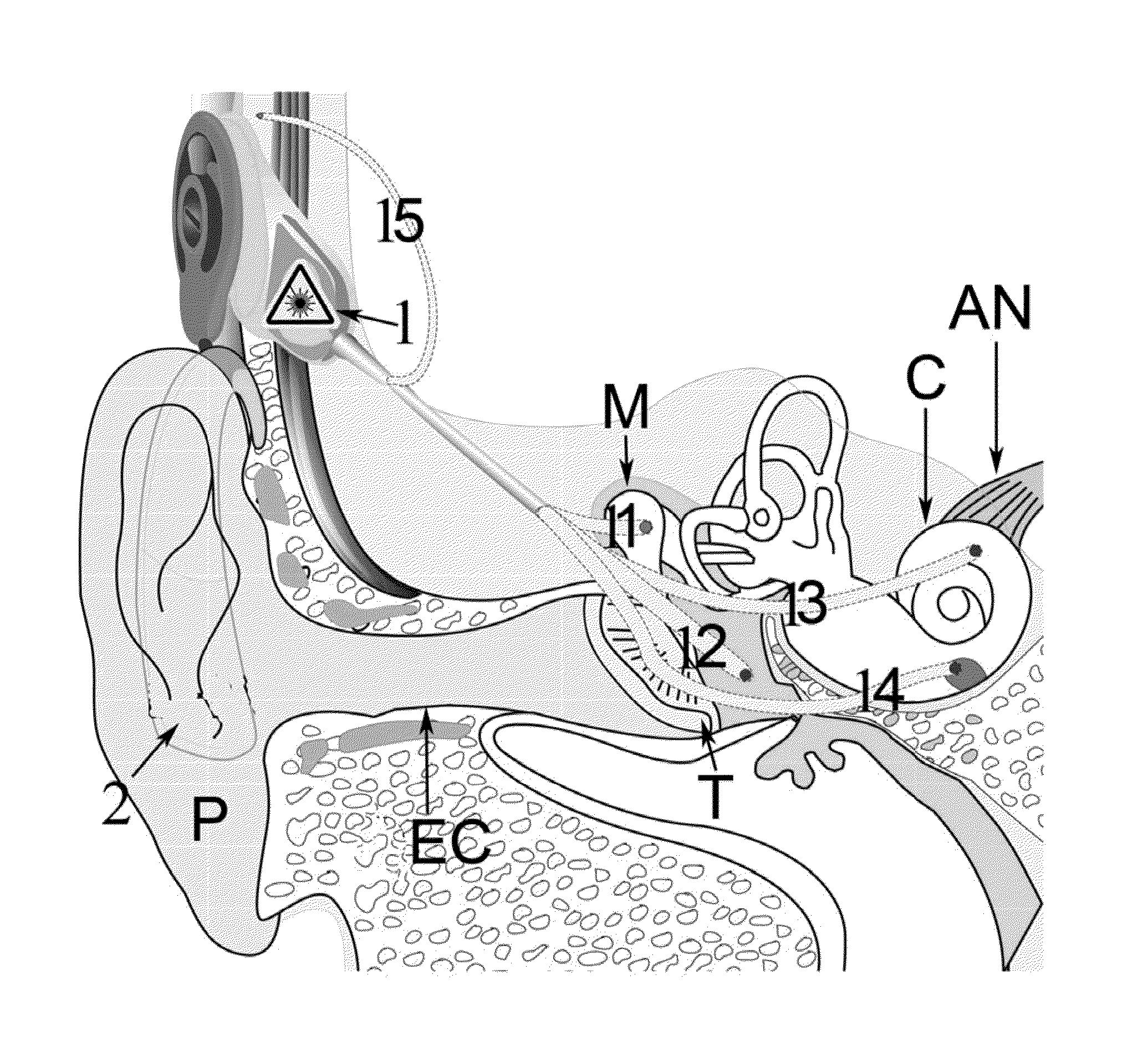 Light activated hearing device