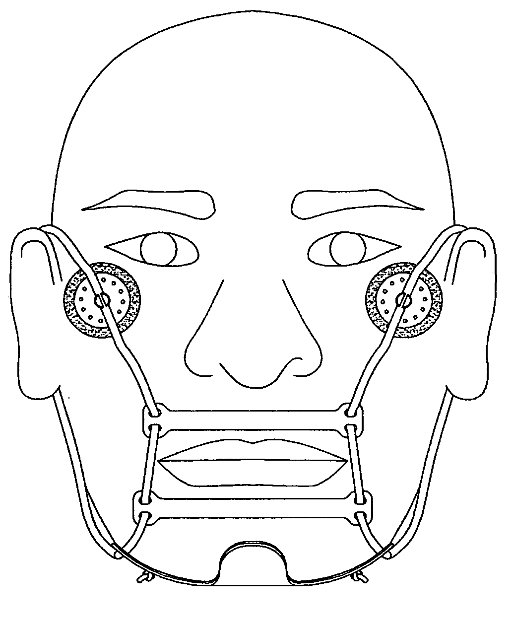 Device for preventing mouth opening during sleep