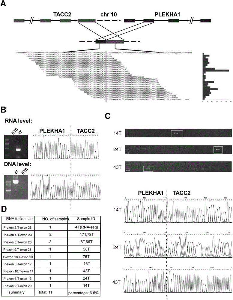 Molecular marker for diagnosing and treating tumors