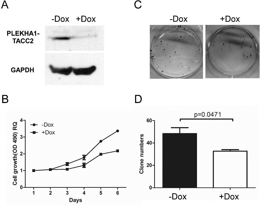 Molecular marker for diagnosing and treating tumors