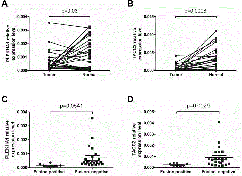 Molecular marker for diagnosing and treating tumors