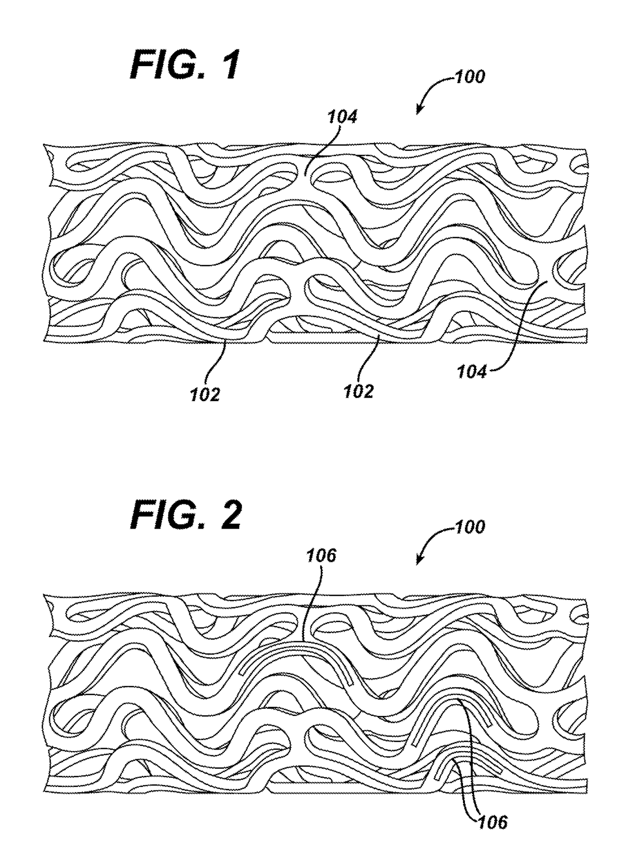 Layer-by-layer stereocomplexed polymers as drug depot carriers or coatings in medical devices