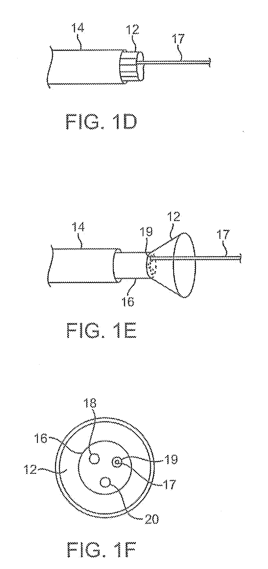 Electrophysiology mapping and visualization system