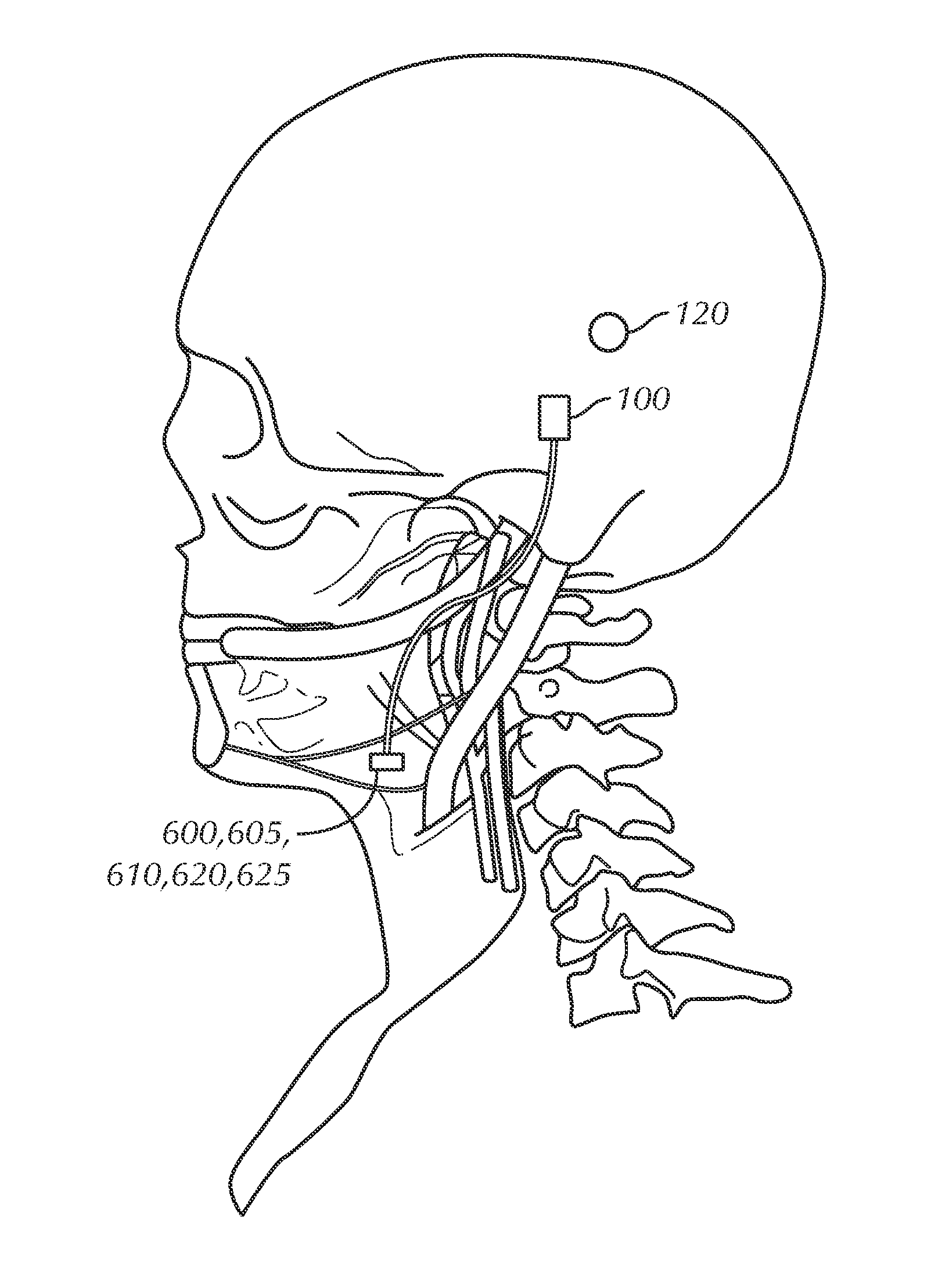 Apparatus, System, and Method for Selective Stimulation