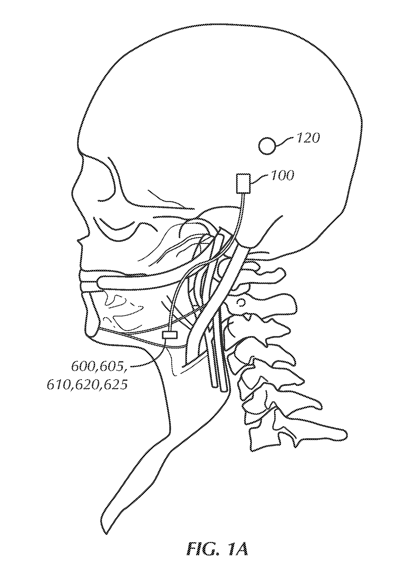 Apparatus, System, and Method for Selective Stimulation