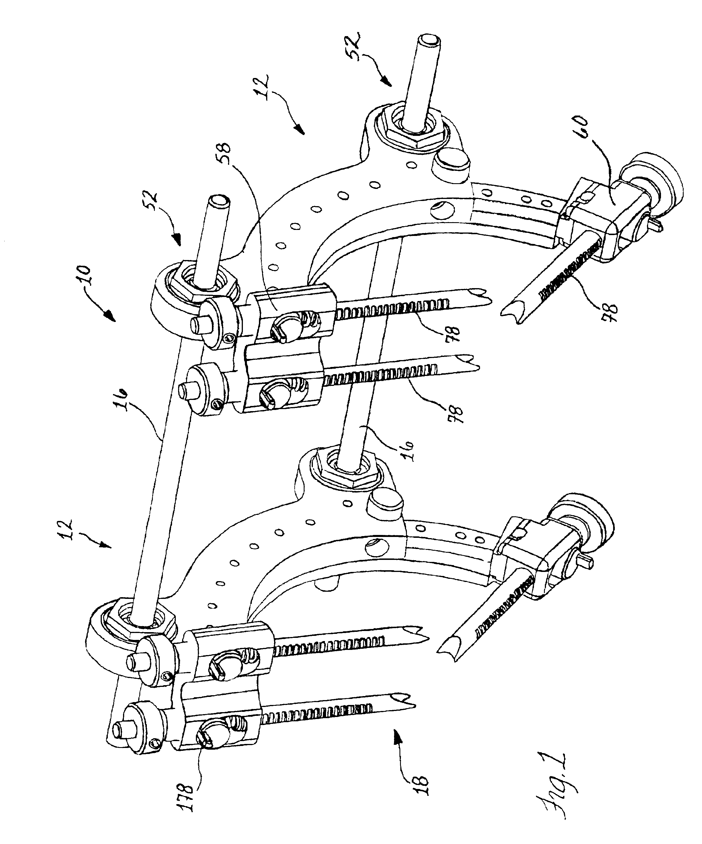 External fixation apparatus and method