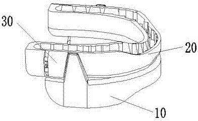 Adjustable snore guard