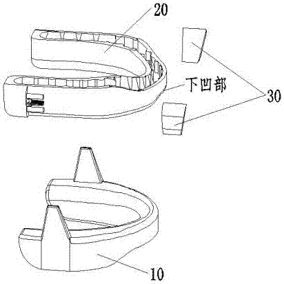 Adjustable snore guard