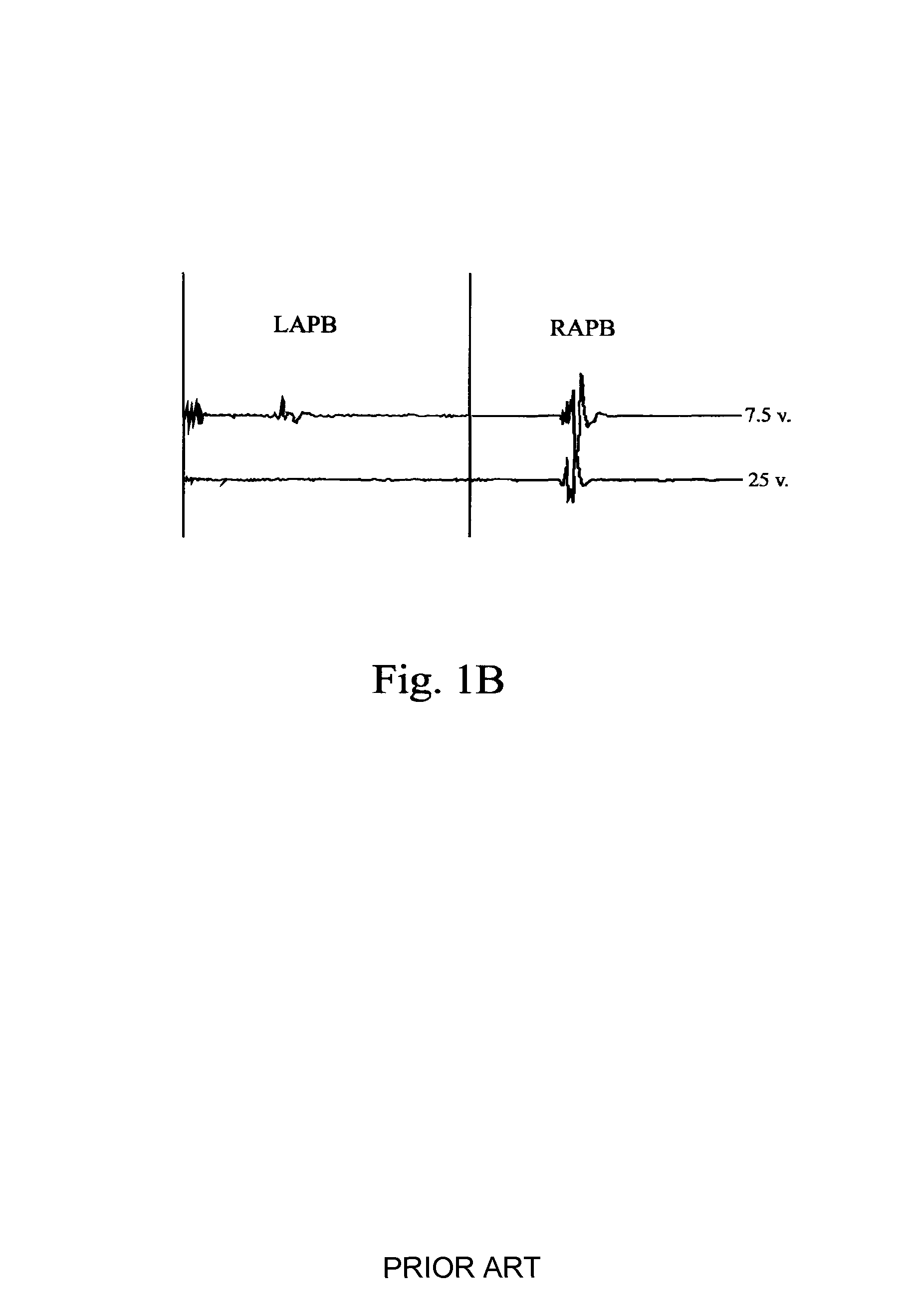 Methods and systems for generating electrical property maps of biological structures