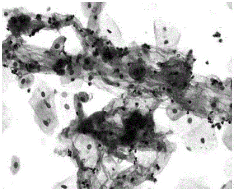 Endocervical cell preserving fluid and method for preparing endocervical cell specimen